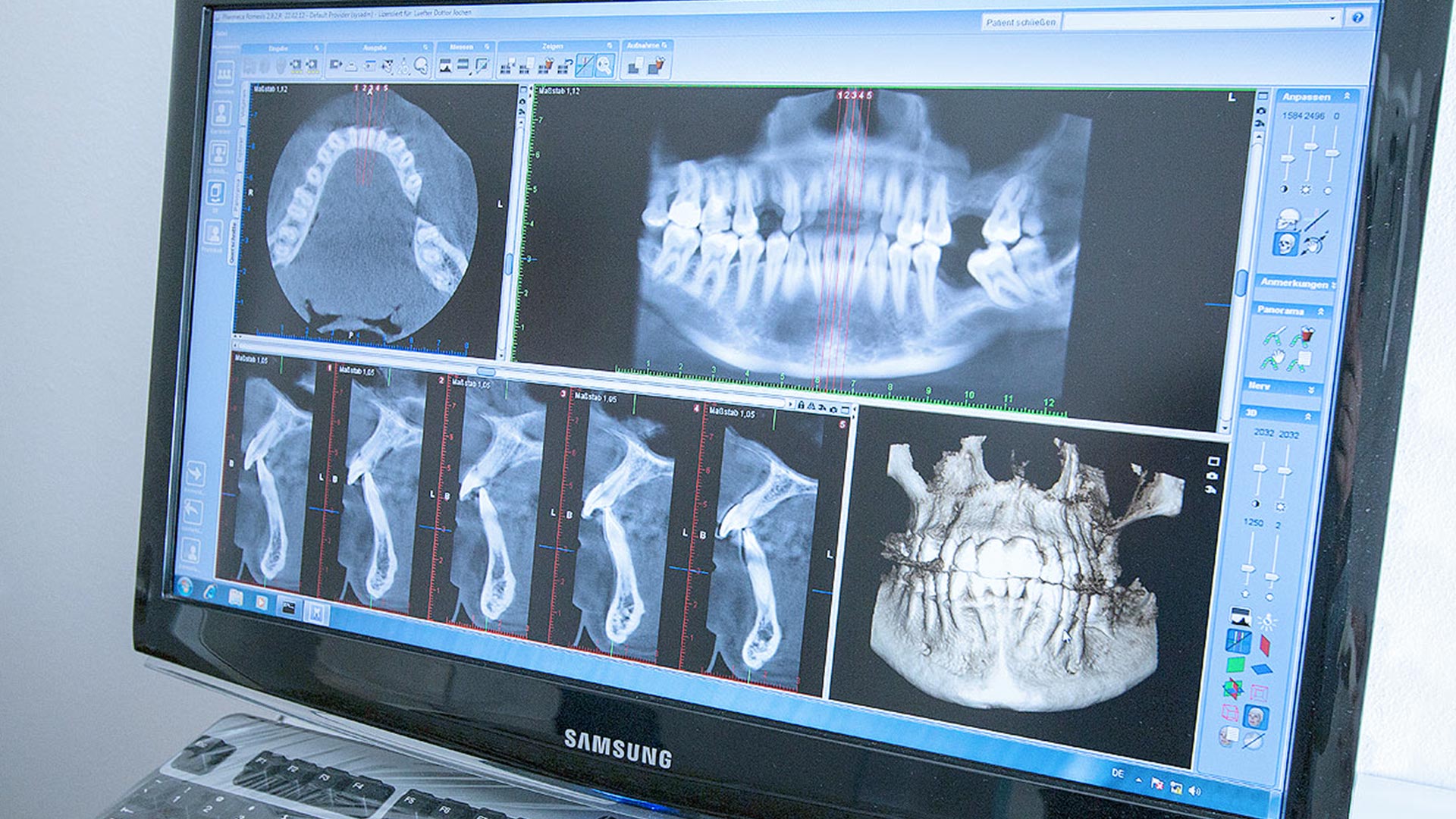 Computergesteuerte Implantologie Südtirol